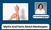 Debunking Common Myths About Monkeypox: Facts You Need to Know - Dr Swati Rajagopal Debunking Common Myths About Monkeypox: Facts You Need to Know - Dr Swati Rajagopal